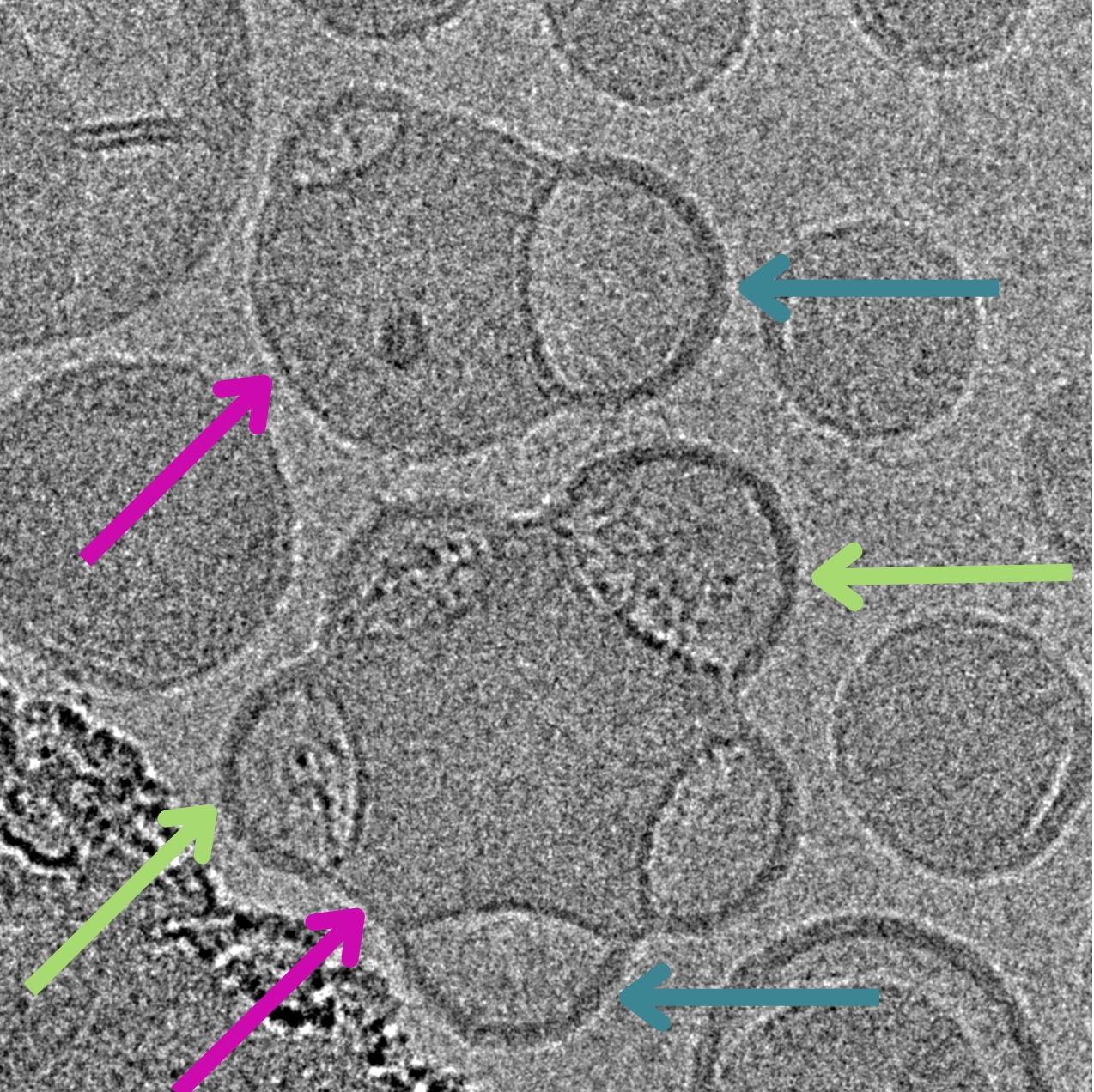 Microscopic black & white image showing cryo-TEM imaging and analysis of lipid nanoparticle LNPs with blebs | LNP characterization services with cryo-TEM | NIS