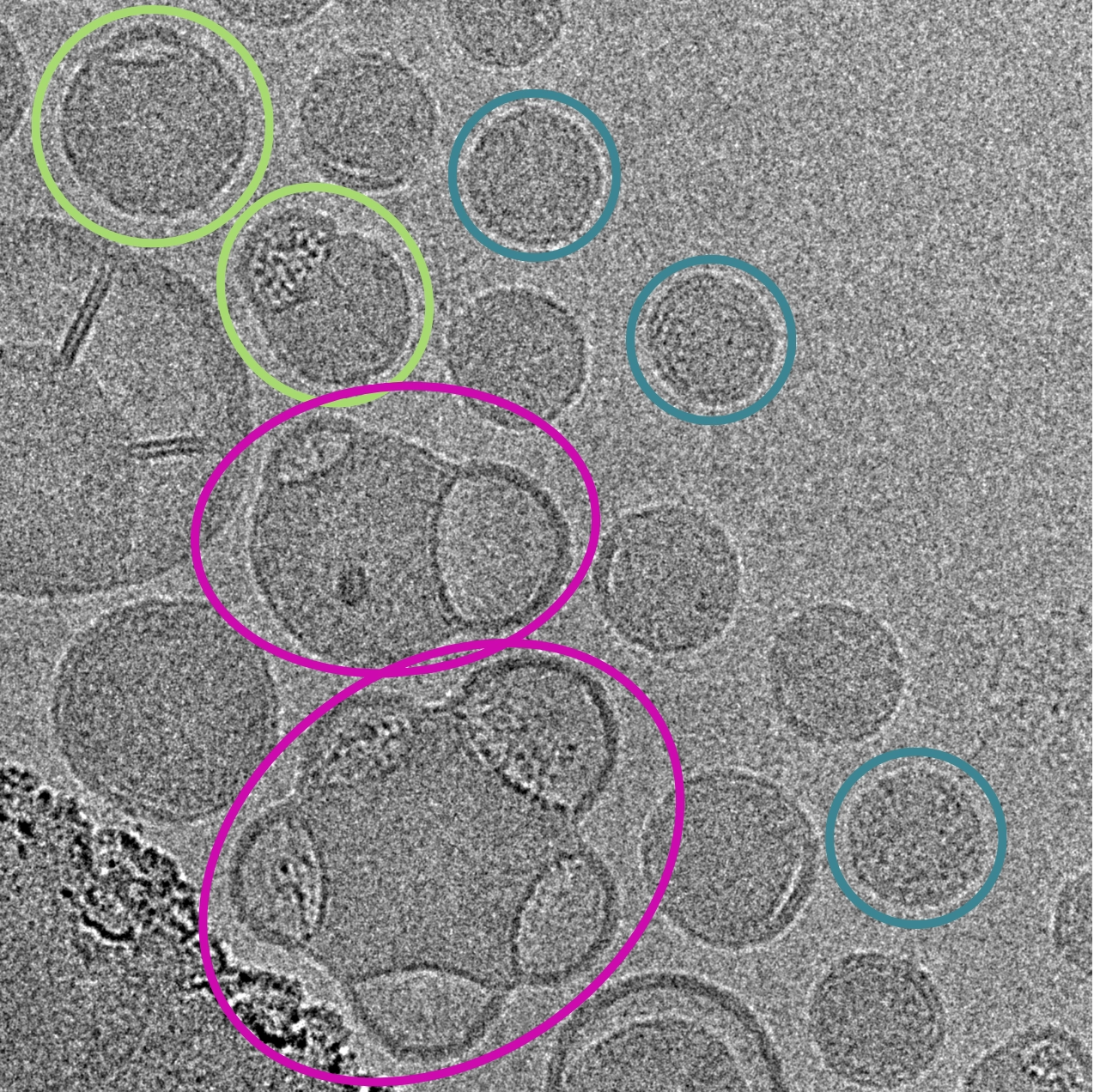 Microscopic black & white image showing cryo-TEM imaging and analysis of lipid nanoparticle LNPs with blebs | LNP characterization services with cryo-TEM | NIS