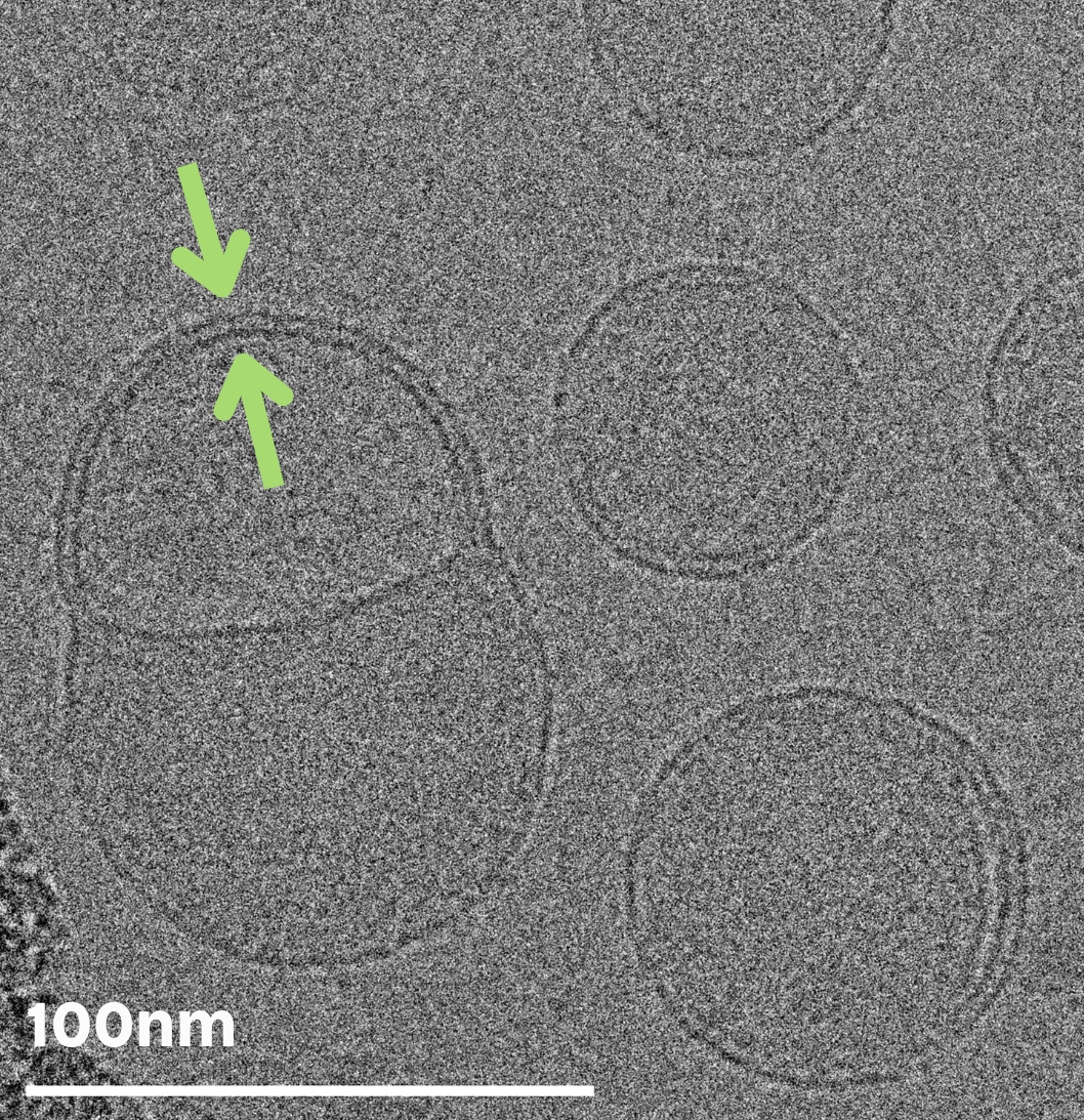 Microscopic black & white image showing cryo-TEM imaging and analysis of lipid nanoparticle LNPs with blebs | LNP characterization services with cryo-TEM | NIS
