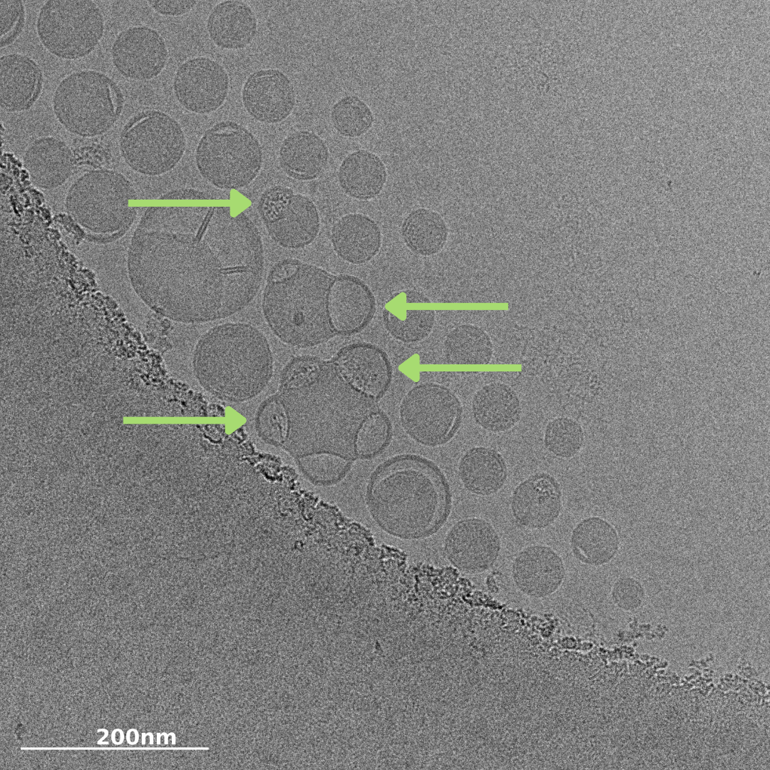 microscopic black and white image of mRNA encapsulated bleb formations on lipid nanoparticle characterization with cryo-TEM from NanoImaging Services