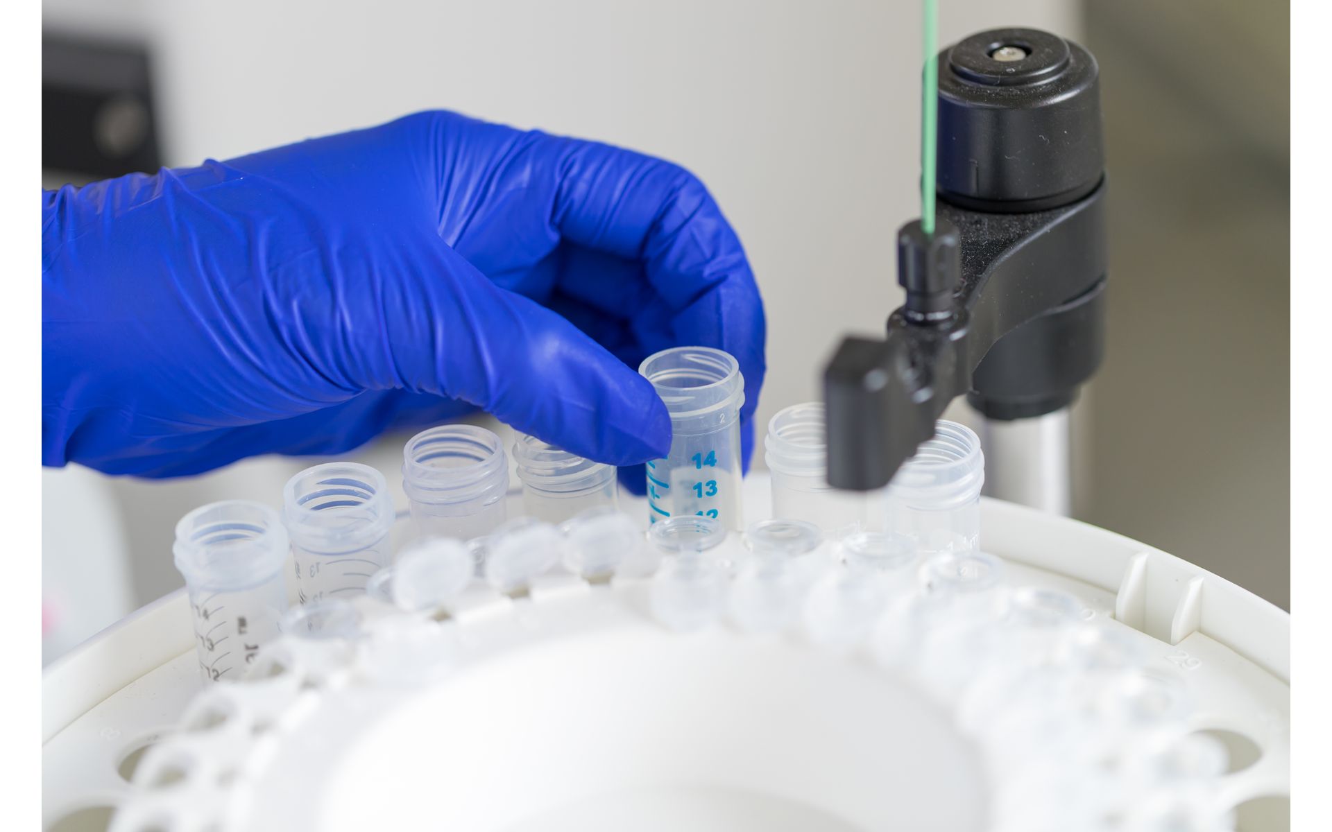Maximizing Impact: Long-term Storage of Recombinant Antigens