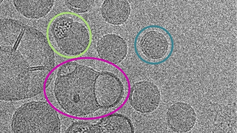 The Bleb Blog: A Deep Dive with Cryo-TEM