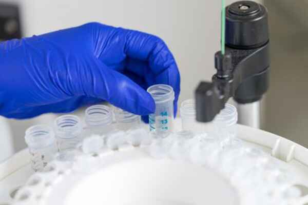 Recombinant Antigens: Long-term Storage