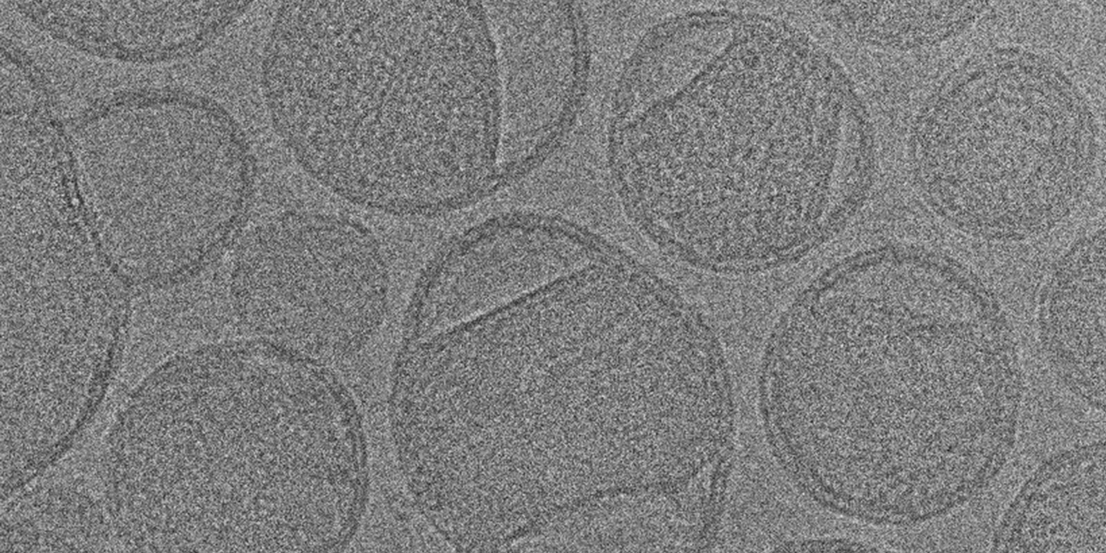 Seeing Through the Fog: Using Cryo-TEM to Characterize LNPs from Formulation Through Manufacturing