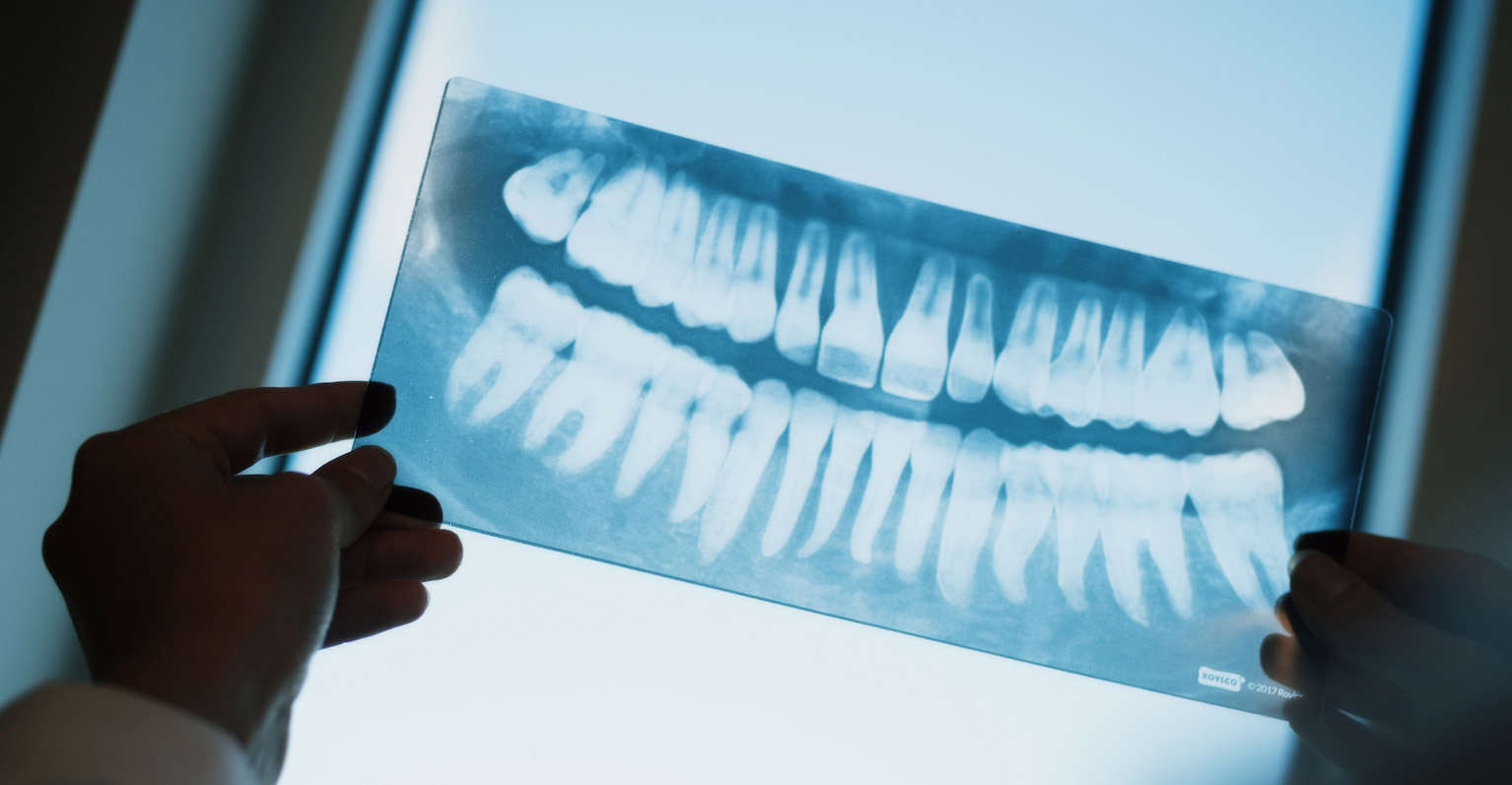 Hands holding a dental X-ray film up to a lightbox