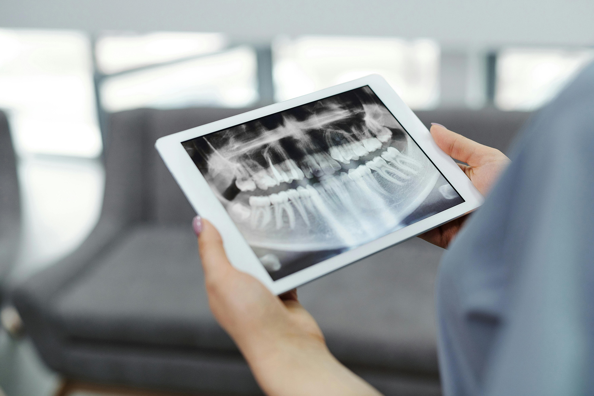 Dental professional holding a tablet displaying a full-mouth dental X-ray