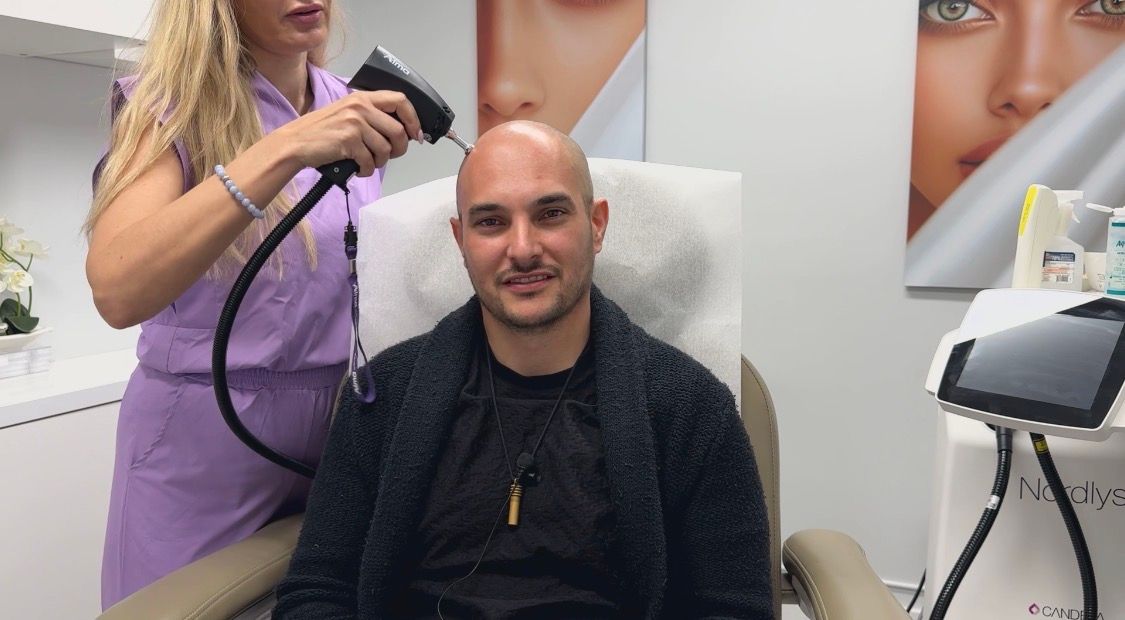 Luminex Alma TED hair restoration treatment being performed in-office