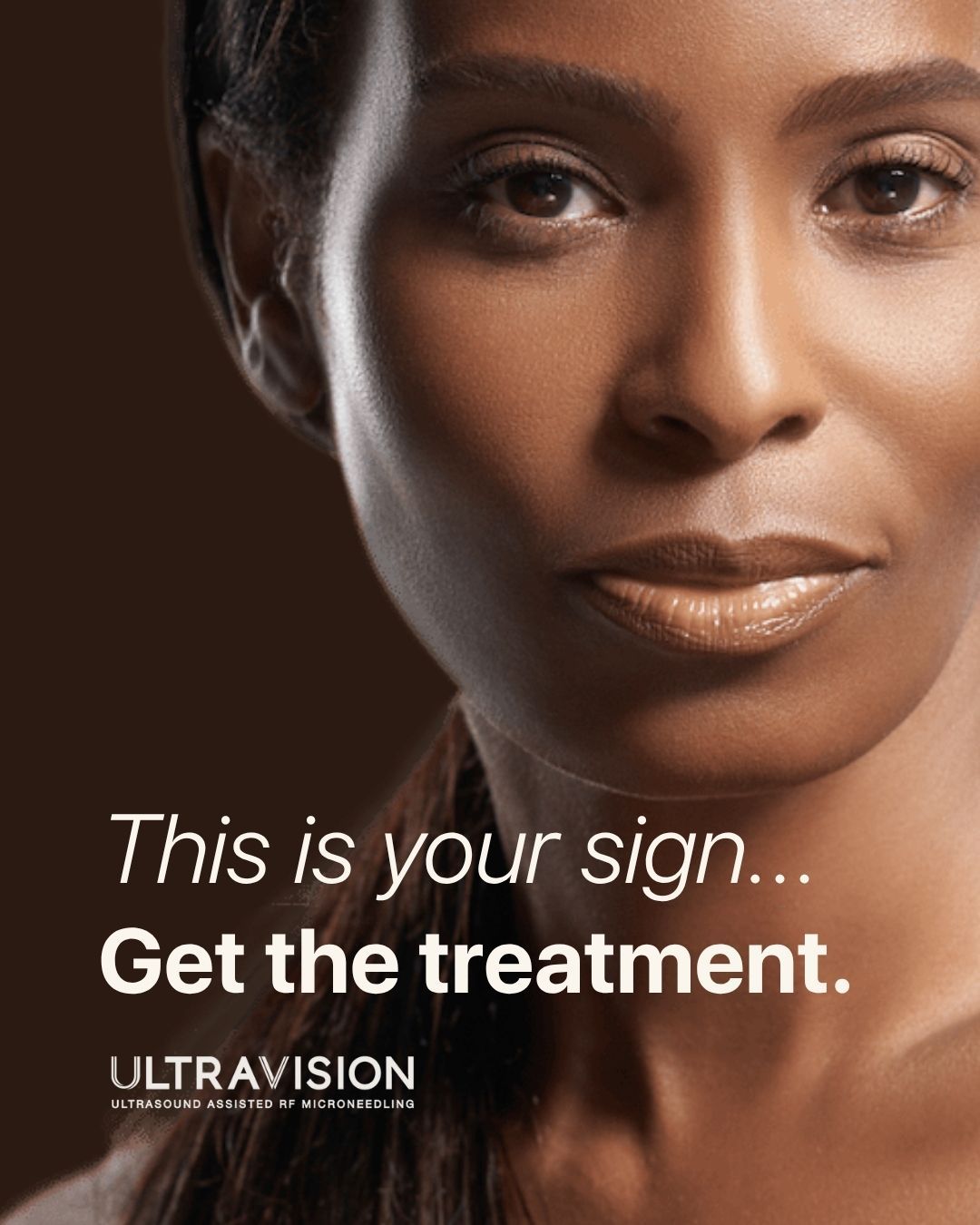 Woman with glowing skin — this is your sign to get the treatment