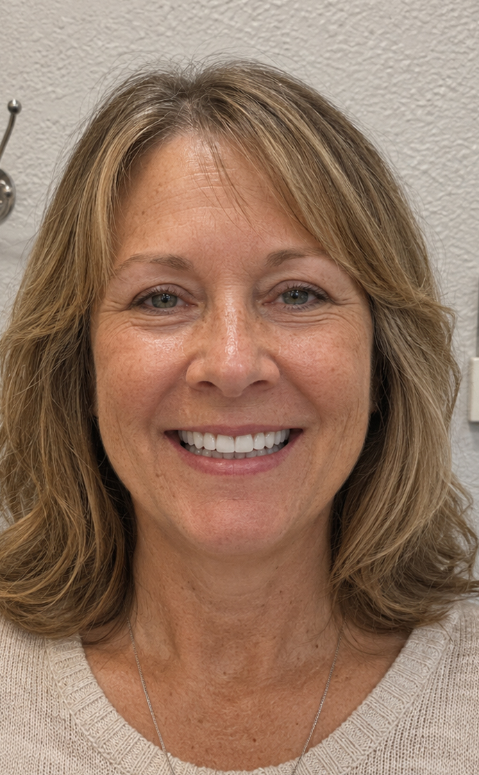 Same patient after dental restoration at C. Patrick Gray, DDS. in Flint, MI, showing a complete, natural-looking smile