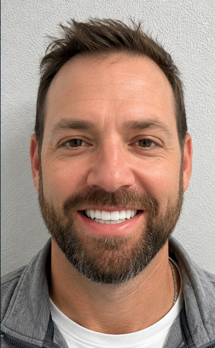 Same patient after dental restoration at C. Patrick Gray, DDS. in Flint, MI, showing a bright, complete smile