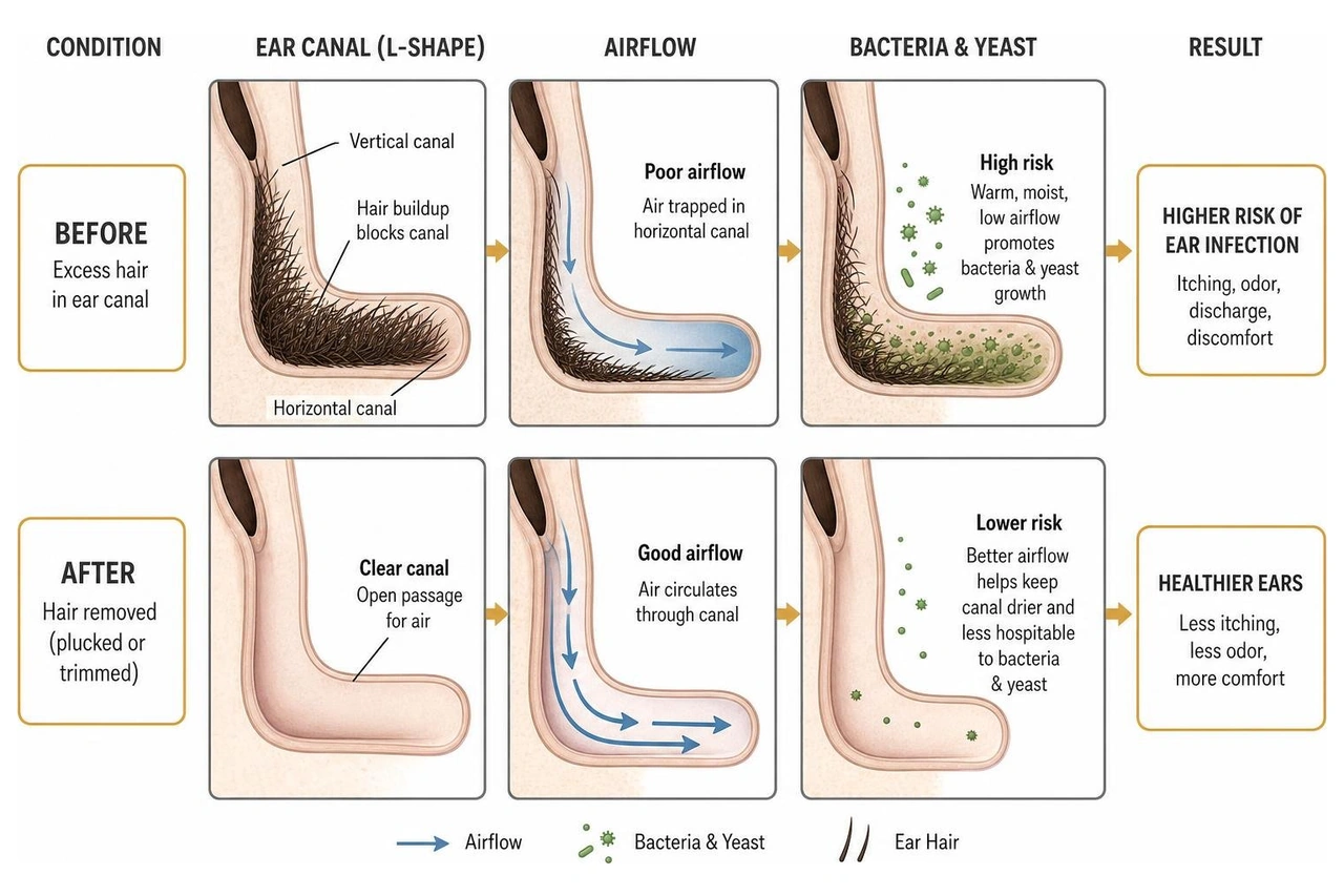 Diagram showing how ear hair removal affects airflow and bacteria in the L-shaped ear canal Diagram showing how ear hair removal affects airflow and bacteria in the L-shaped ear canal