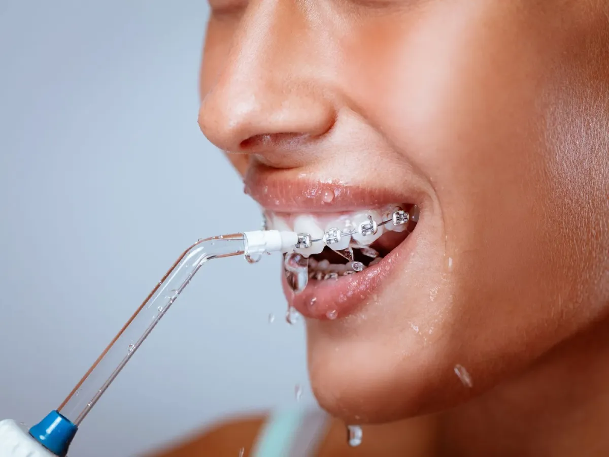Close-up of a person with metal braces receiving dental cleaning from a water flosser, with droplets spraying from the mouth in a clinical setting.