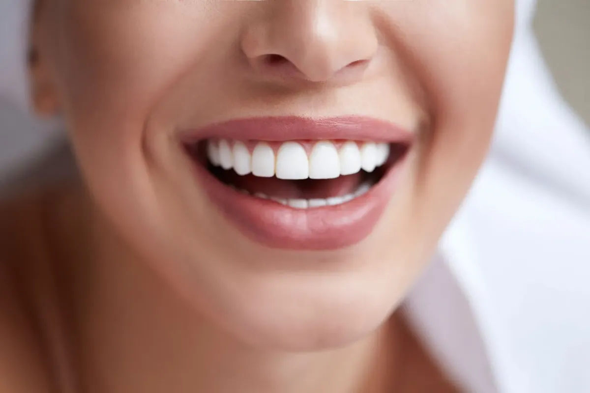 Close-up of a person smiling broadly, showing bright, straight white teeth and healthy lips; the image conveys happiness, confidence, and dental care.
