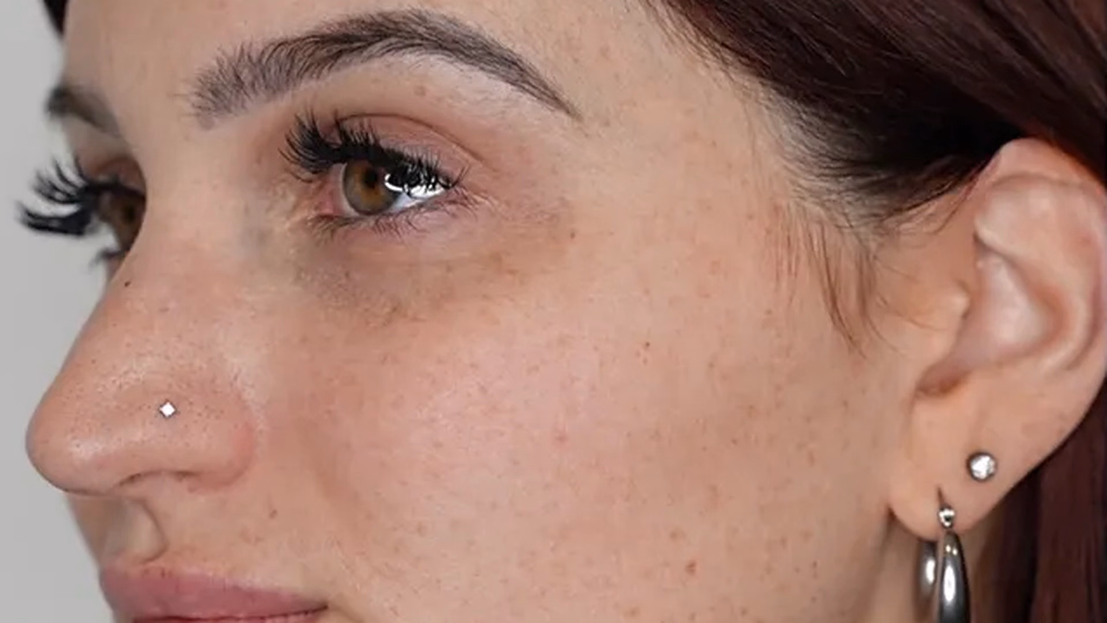 Facial balancing before photo of a VIV Wellness patient in Dallas