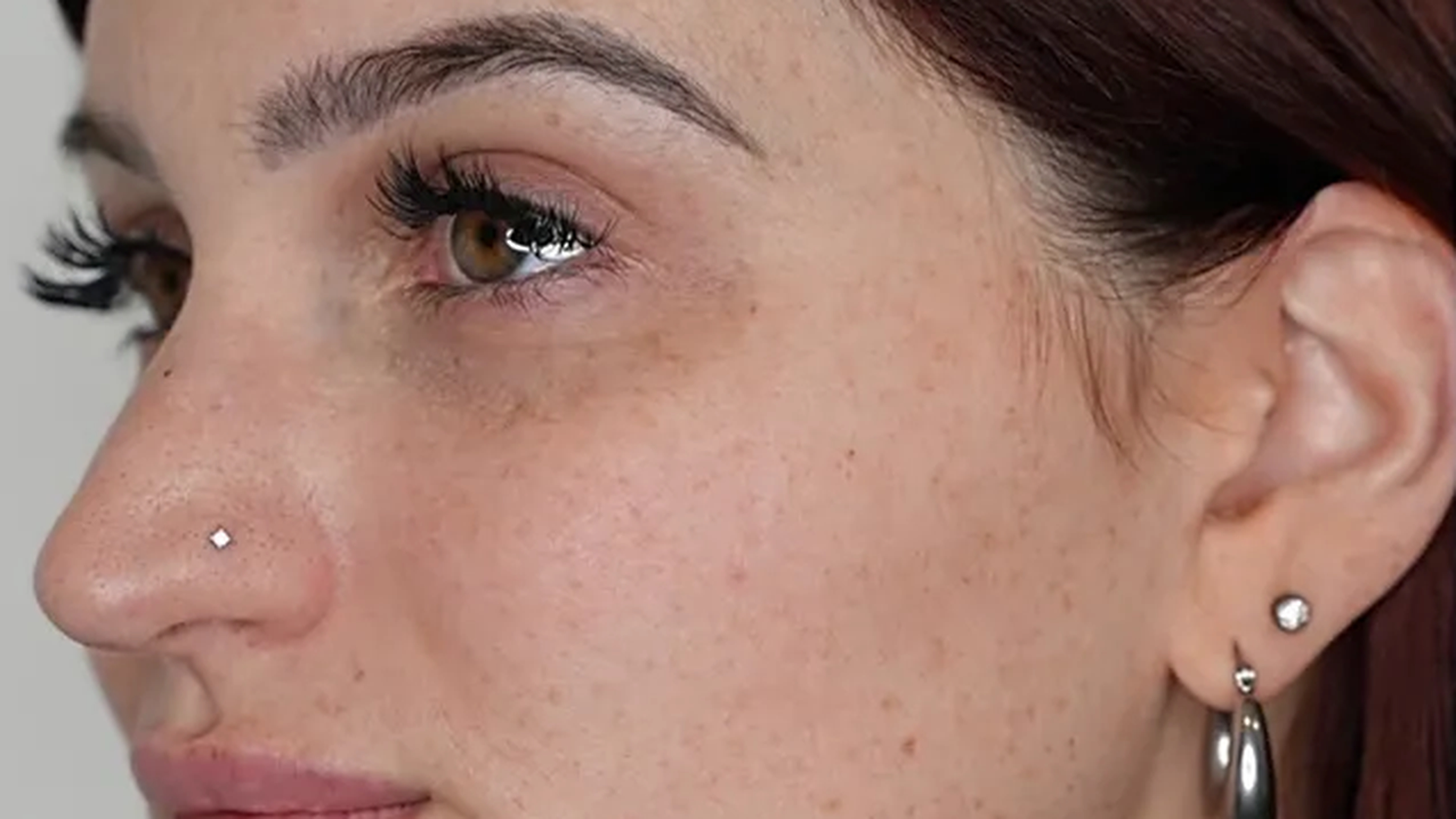Facial balancing before photo of a VIV Wellness patient in Dallas