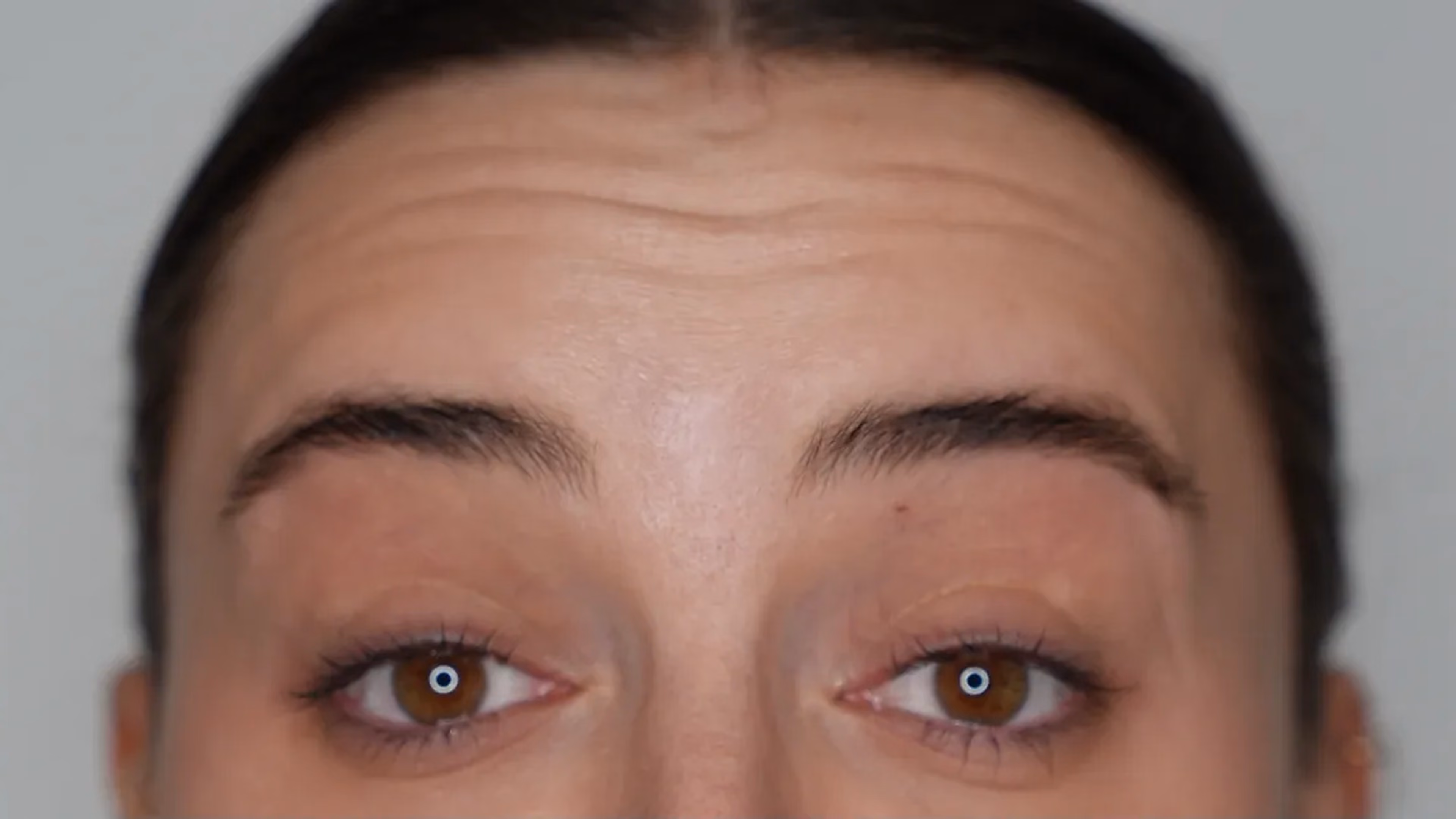 Lash treatment before at VIV Wellness Dallas