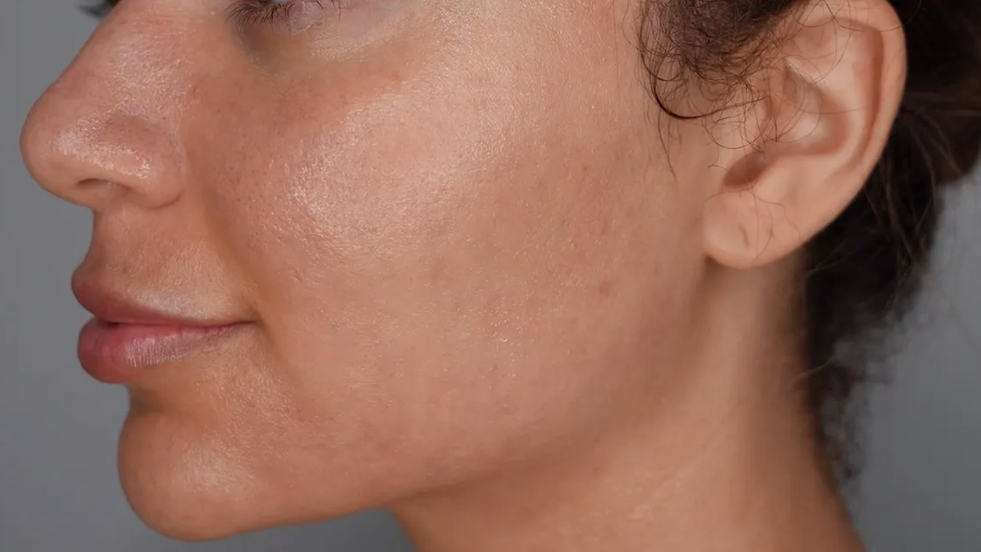 Skin rejuvenation after treatment at VIV Wellness Dallas