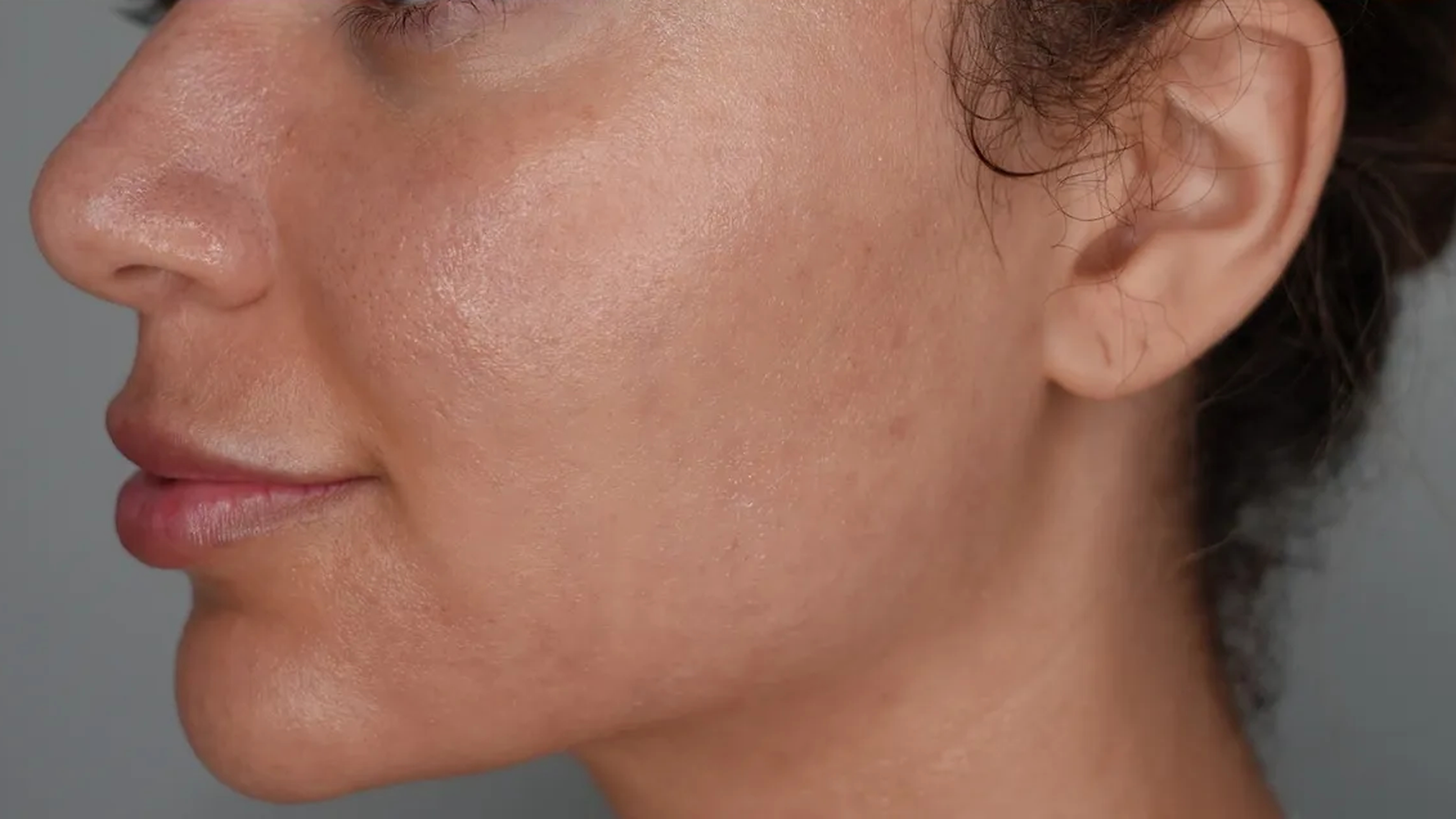 Skin rejuvenation after treatment at VIV Wellness Dallas