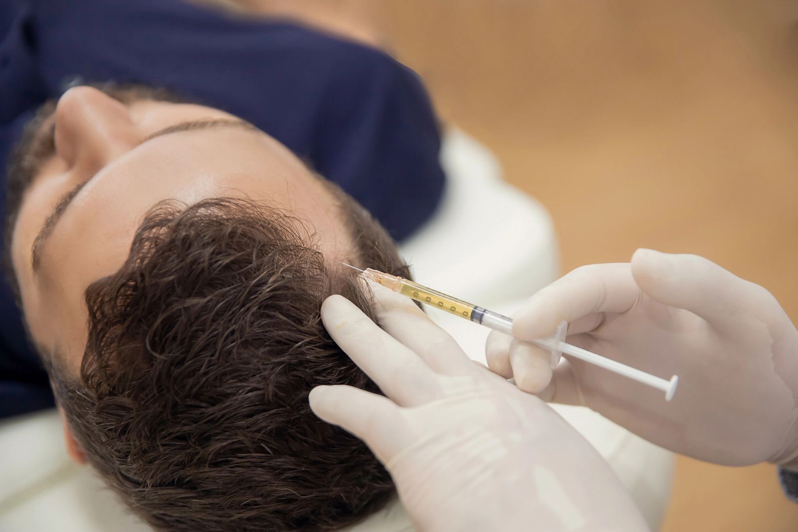 PRP scalp injections for hair restoration at VIV Wellness in Dallas