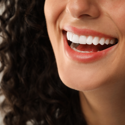 Crowns and bridges from our in-house lab in Henderson NV - Densley Dental
