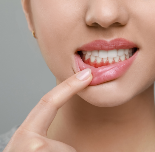 Gum disease treatment in Henderson NV at Densley Dental