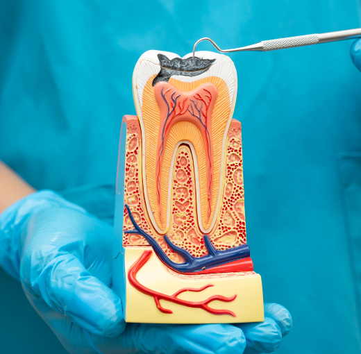 Root canal treatment in Henderson NV at Densley Dental