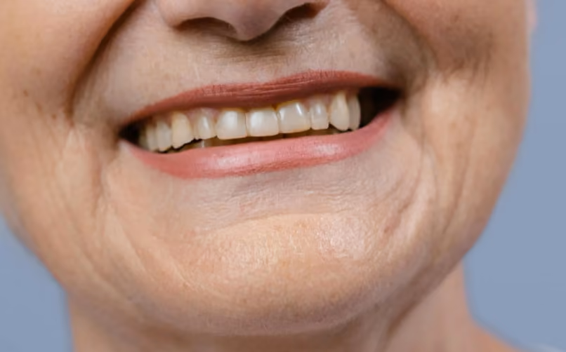 Close-up of an older person's smiling mouth showing teeth and lips with subtle wrinkles around the mouth.