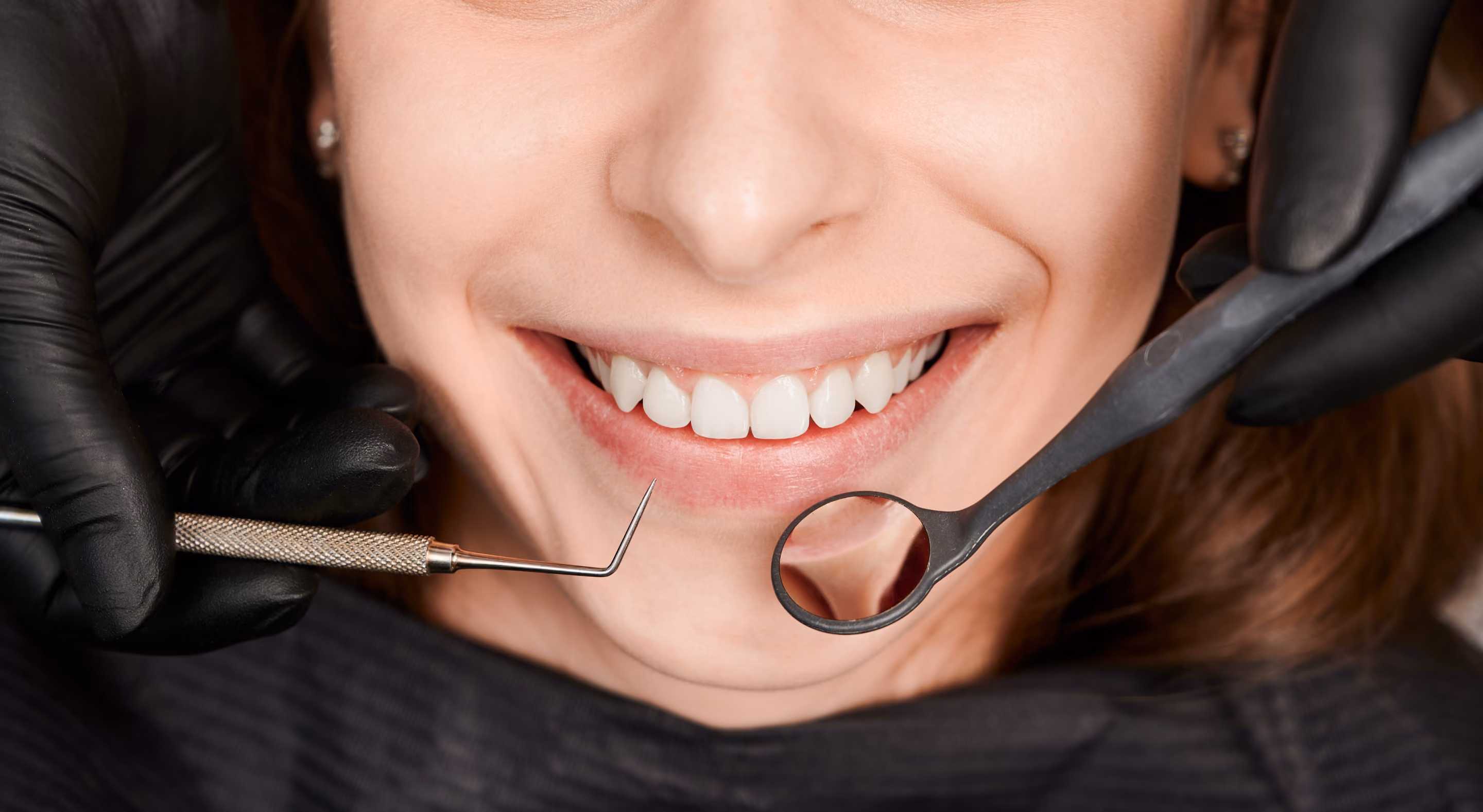 Close-up of a smiling person showing clean teeth while a dentist wearing black gloves holds dental tools near the mouth for examination.