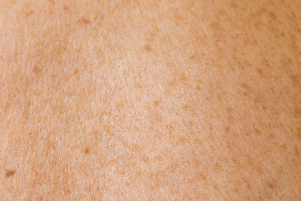 Close-up of lightly freckled skin in a warm neutral tone, abstract texture