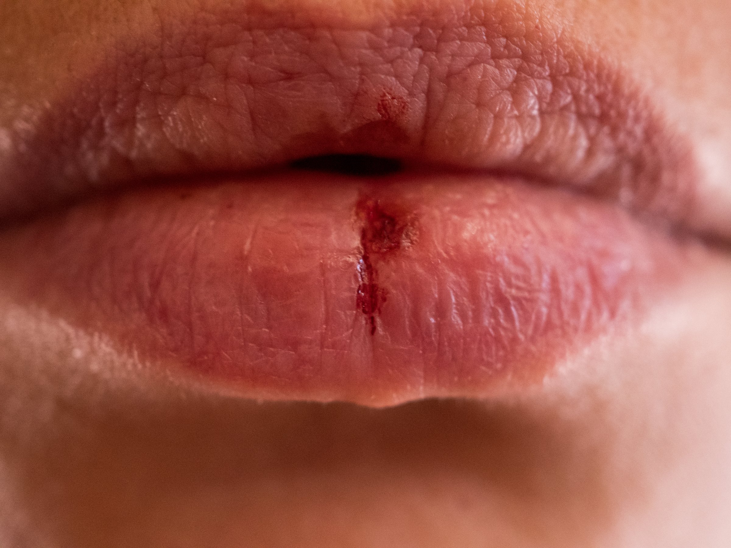 Macro close-up of full lips with a natural matte finish