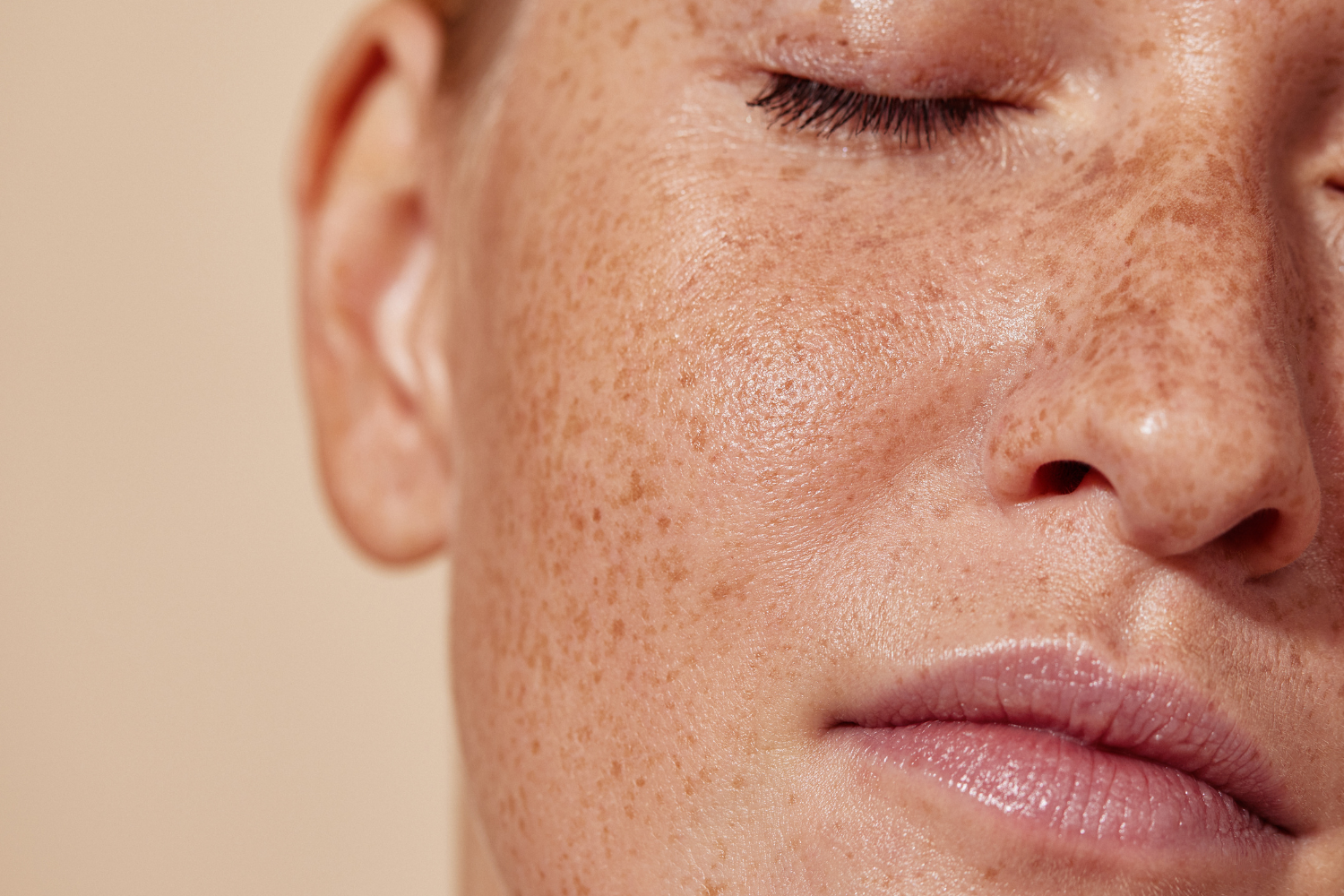CO2 Laser in Minneapolis, Before and After: What to Expect
