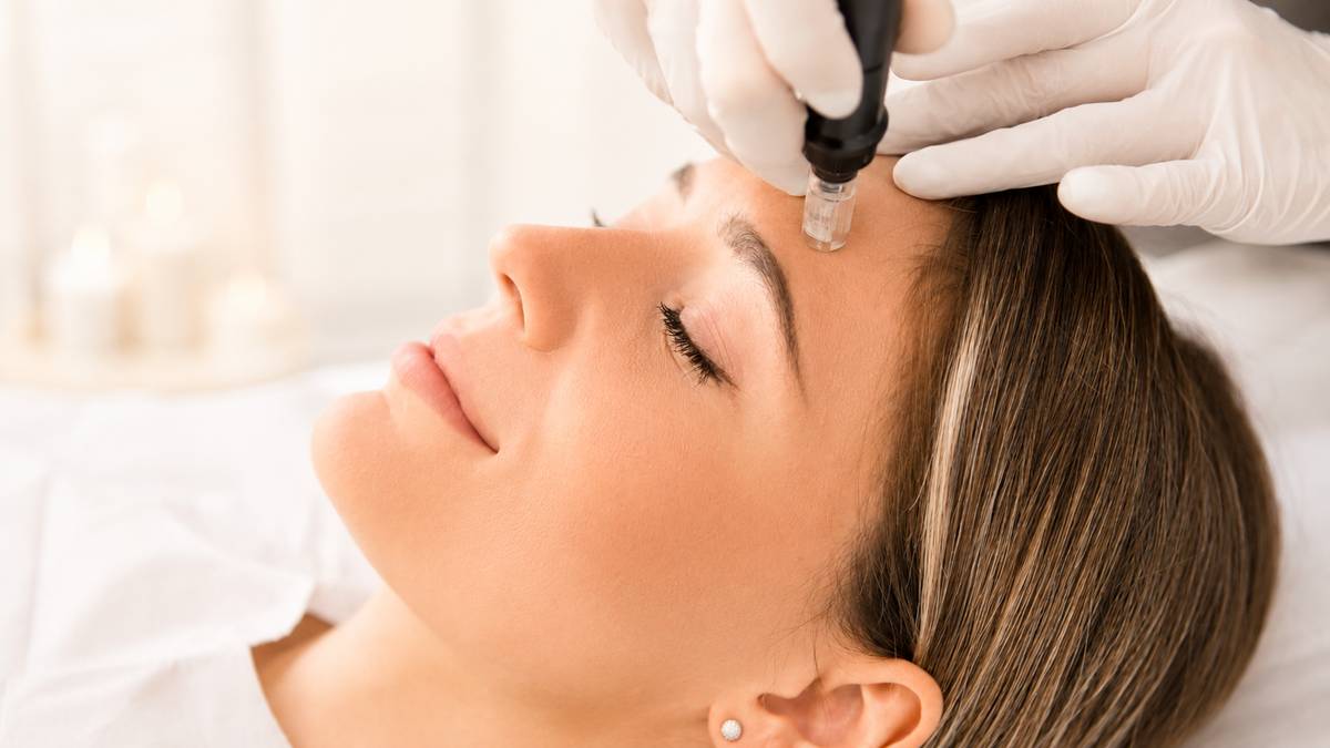 SkinPen® Microneedling