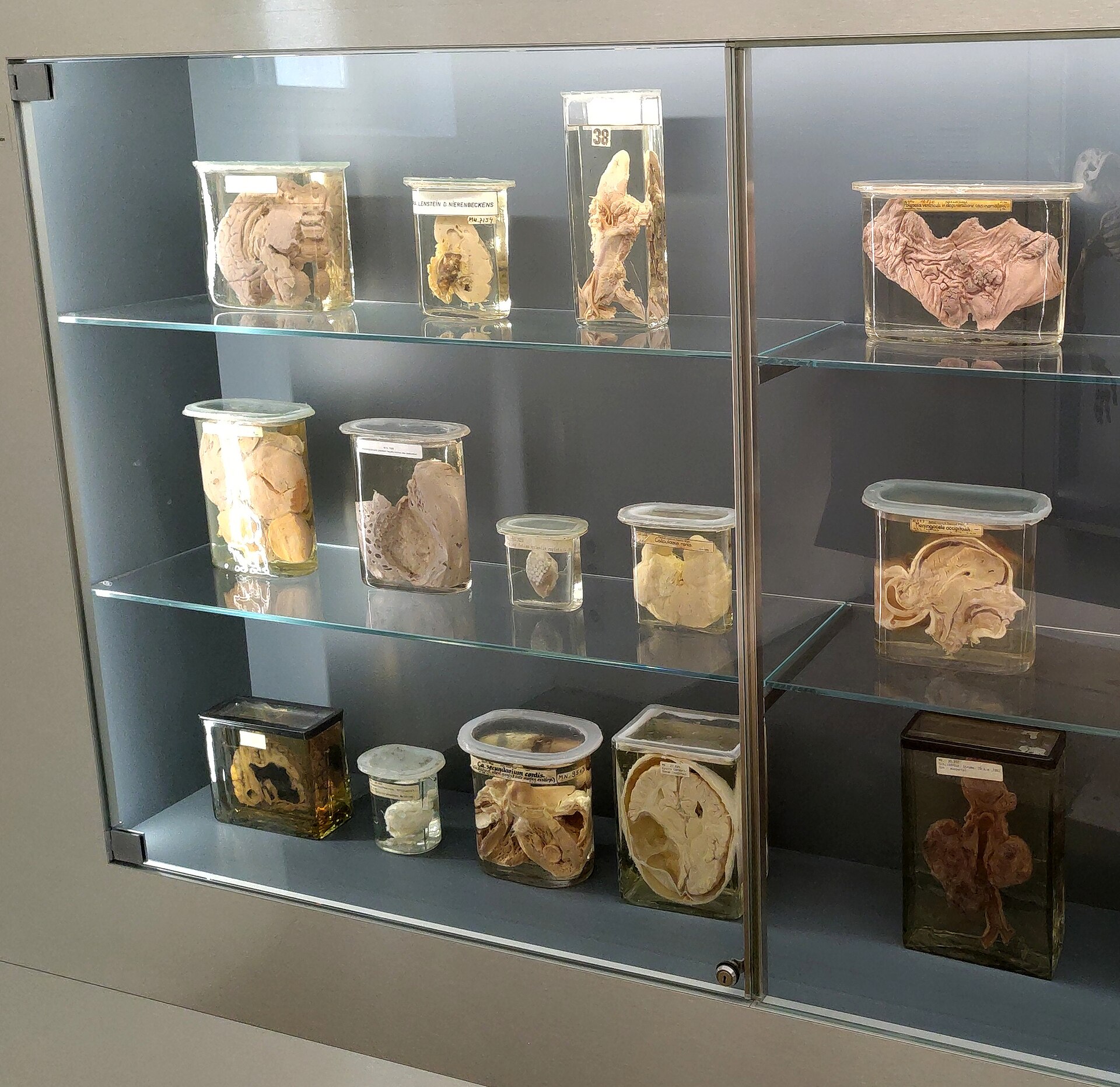Verschiedene Feuchtpräparate in Glaszylindern in der pathologisch-anatomischen Sammlung im Narrenturm.