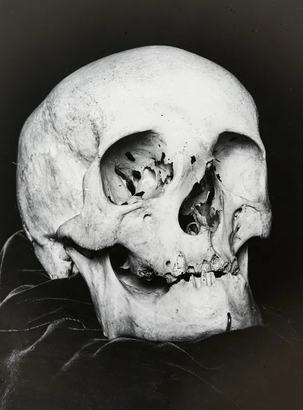 Schädel von Joseph Haydn, Frontalansicht, Fotografie auf einem Glasdia