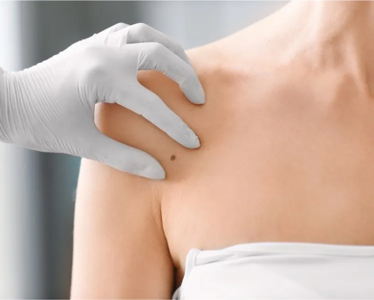 What Happens During a Skin Biopsy? A Step by Step Patient Guide
