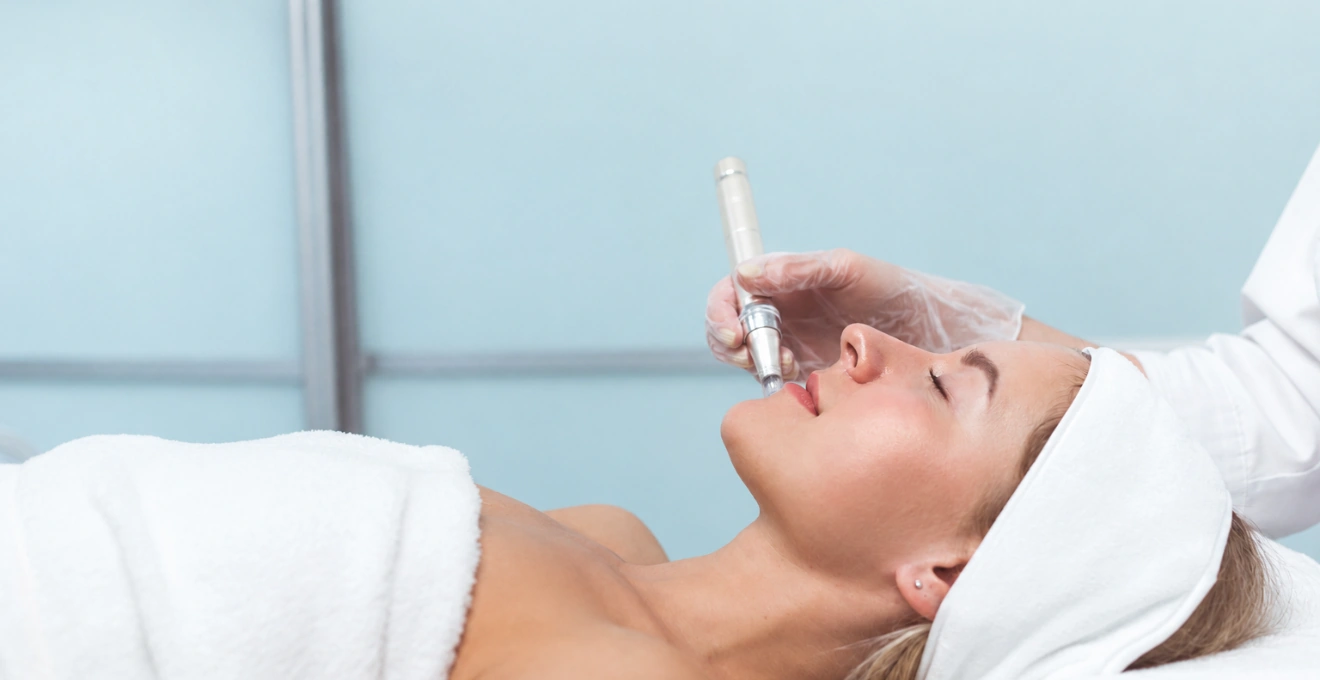 A skin needling treatment in the aesthetics suite at Emerald Avenue Medical Clinic