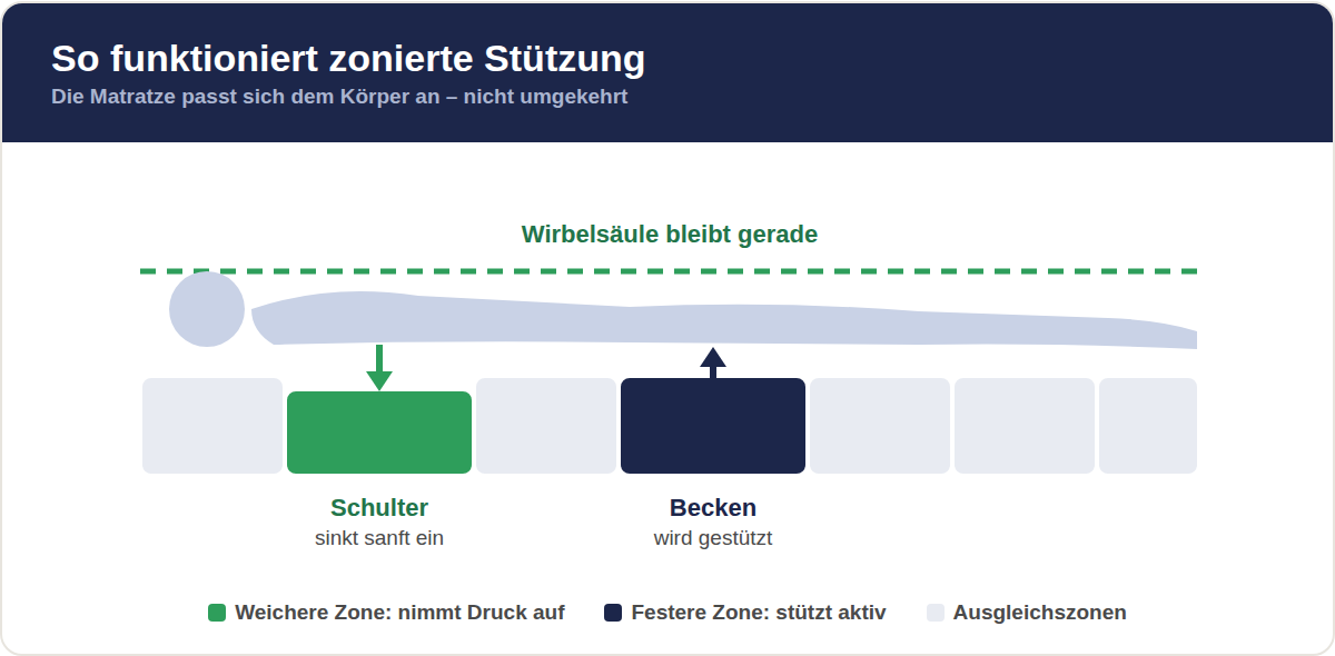 Infografik: So funktioniert zonierte Stützung – Schulter sinkt ein, Becken wird gestützt