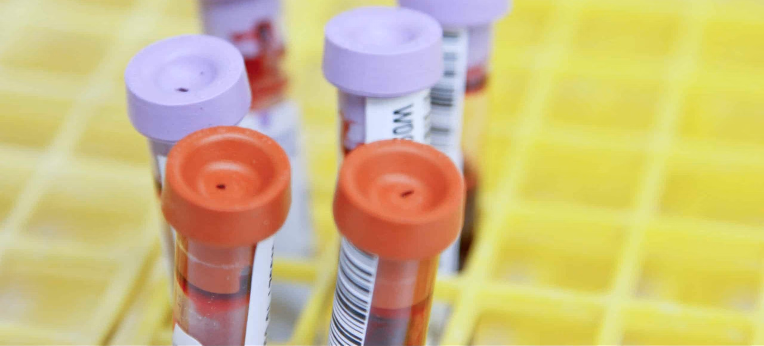Collecting Data for Pharmacokinetics Studies