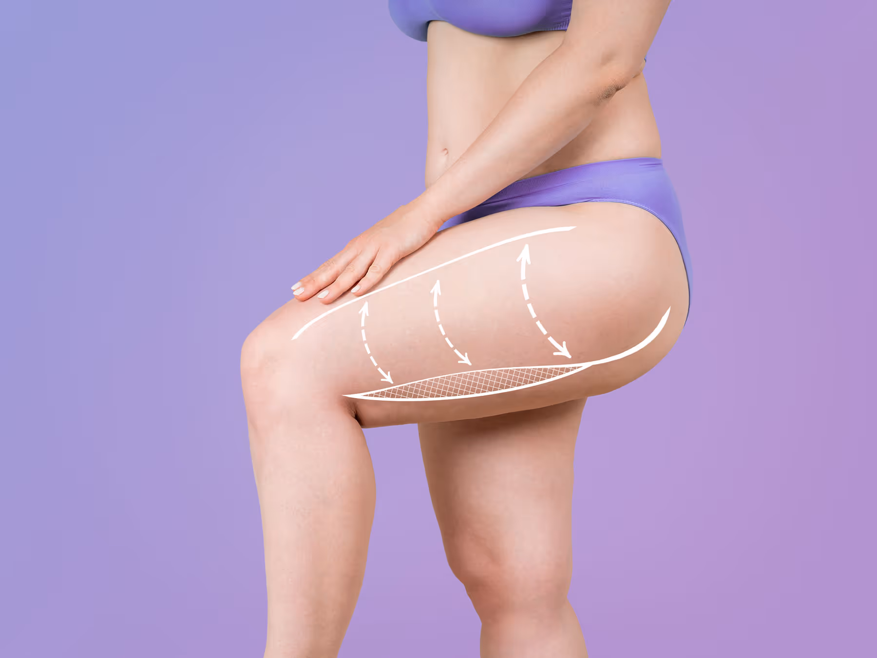 Plastische Chirurgie – Oberschenkelstraffung