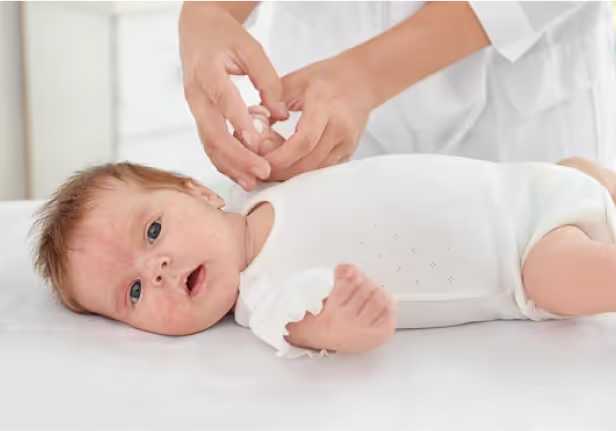 A baby lying on a bed while her mom holds her hands. The baby is looking towards the camera and has eczema on its face. 