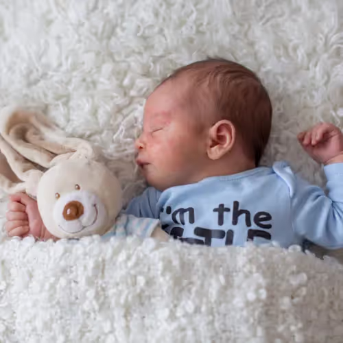 A photo of a baby with a cows milk protein allergy rash asleep beside a stuffed animal