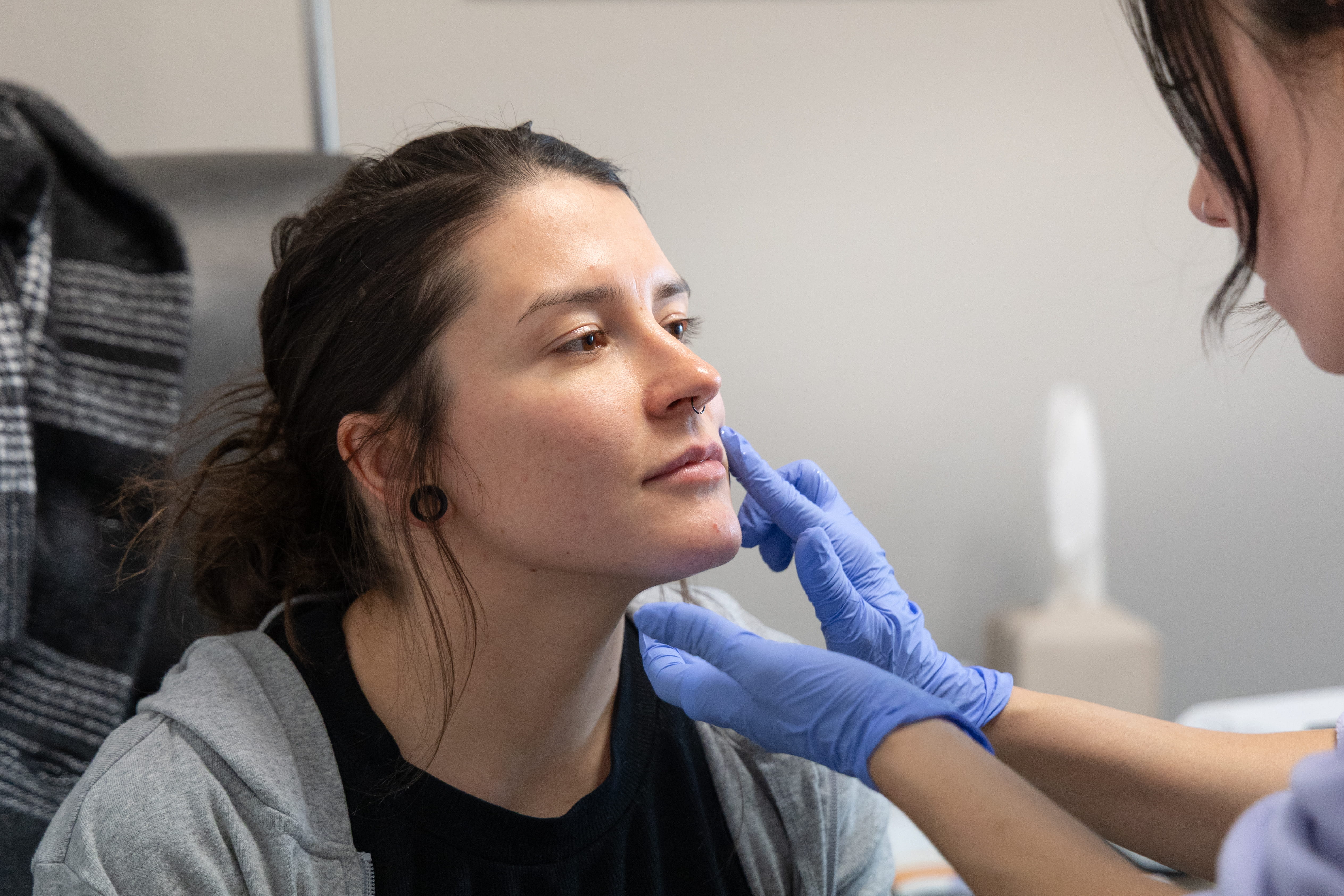 PRF and EZ Gel treatment