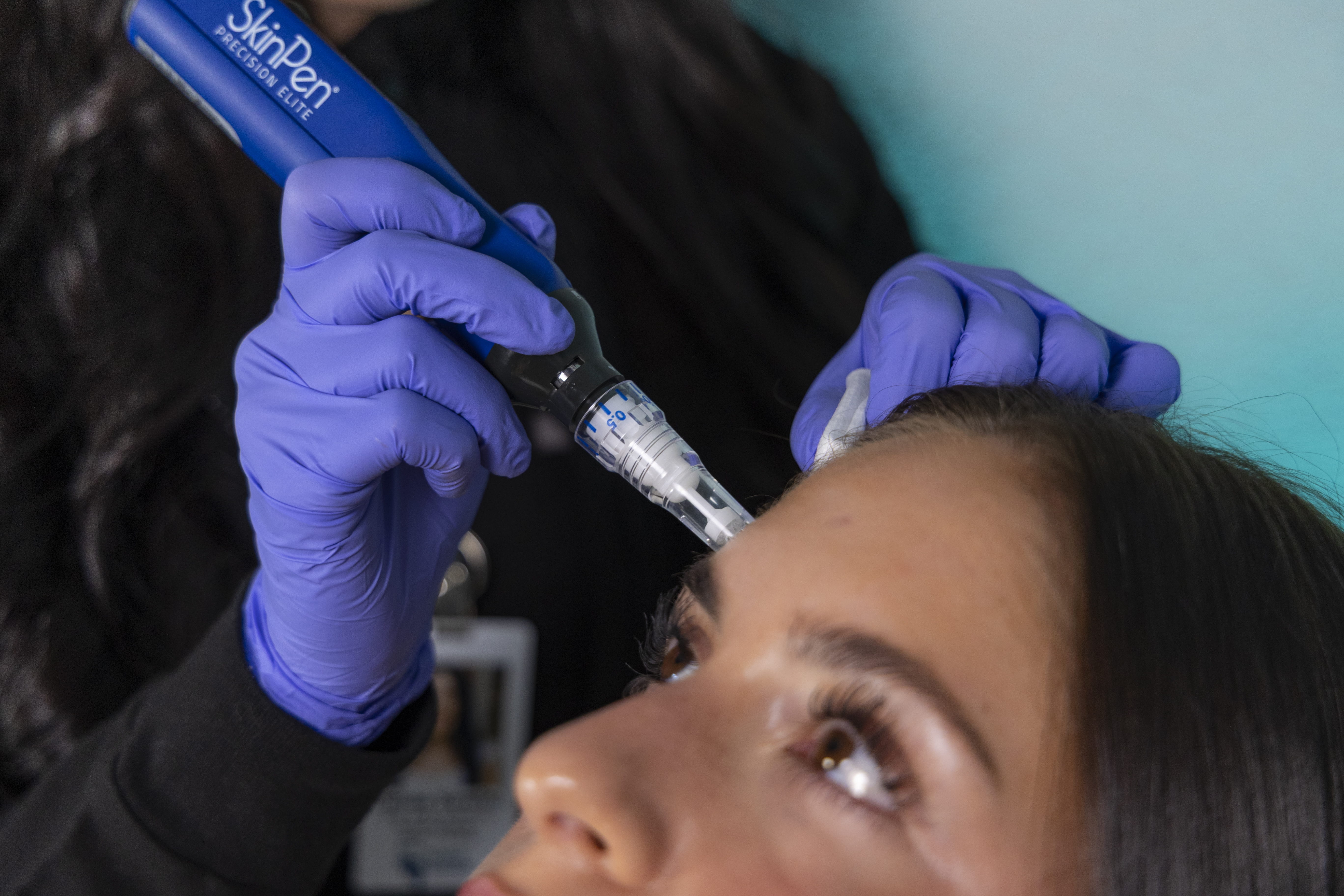 Facial rejuvenation treatment