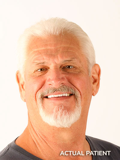 Why Dental Implants
