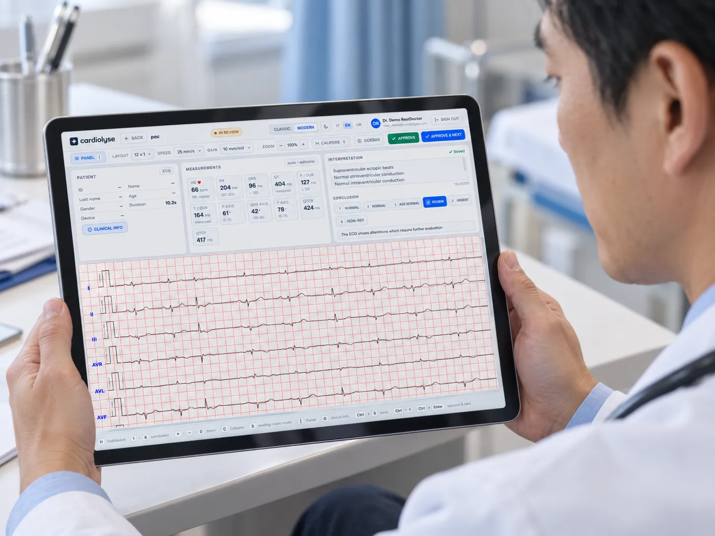Doctor holding a tablet displaying an ECG report with heart rate and measurements, showing detailed heart activity with red gridlines and interpretation notes on the screen.