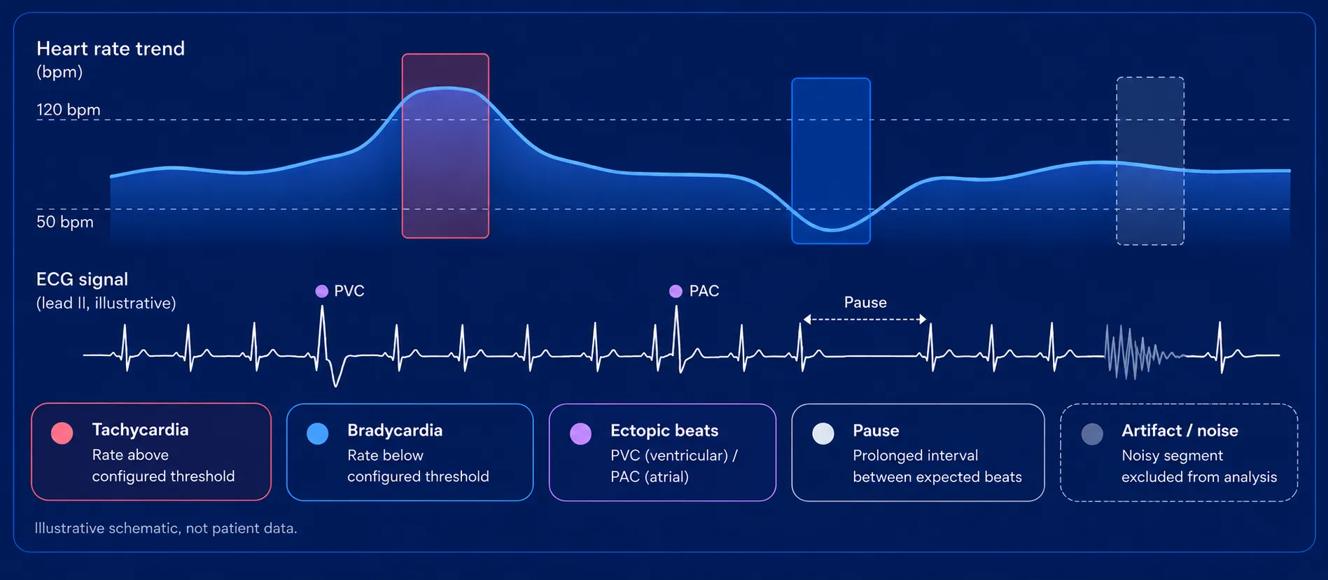 Graph showing heart rate trend and ECG signal with labeled examples of tachycardia, bradycardia, ectopic beats (PVC ventricular, PAC atrial), pause, and artifact/noise, with color-coded boxes explaining each condition and a schematic ECG lead II tracing illustrating these abnormalities.