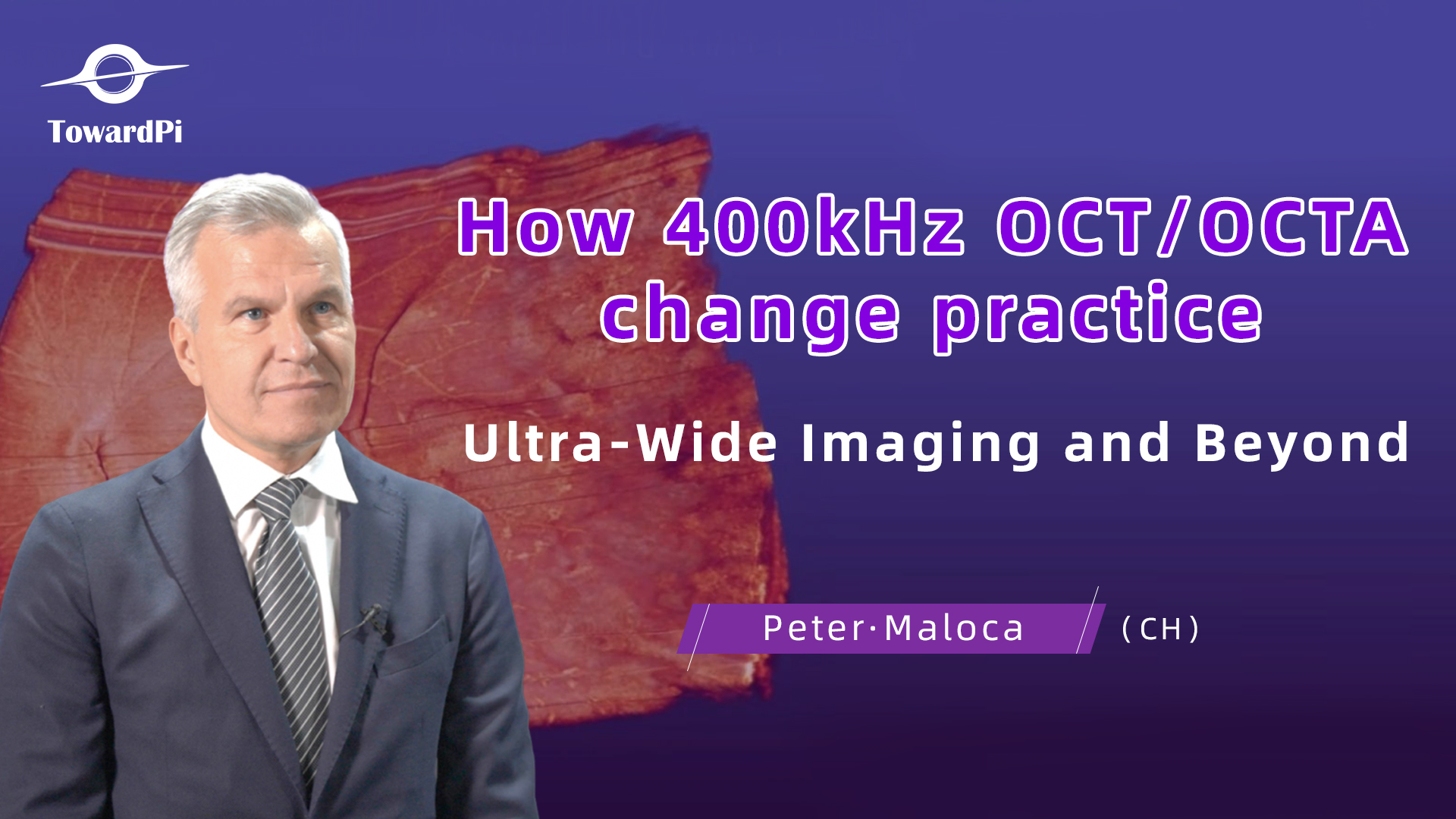 Prof. Peter Maloca – wykład o ultraszerokim obrazowaniu OCT