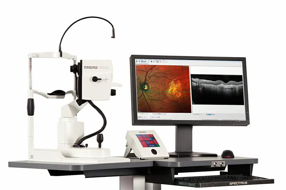 Spectralis ophthalmic imaging system with a white examination device featuring a chin rest and eye lens, connected to a computer monitor displaying detailed retinal scans and cross-sectional eye images, placed on a dark gray table with a control panel and keyboard tray.