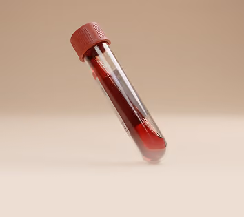 Close-up of a tilted blood collection tube filled with blood against a beige background.