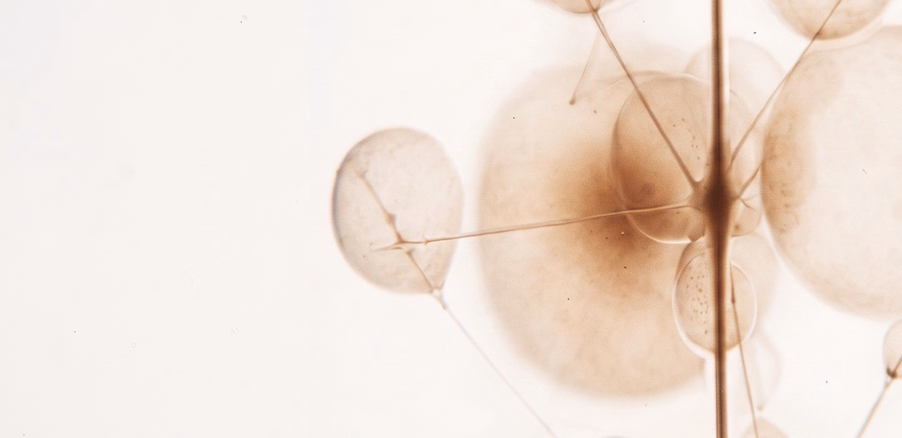Close-up view of translucent, brown circular shapes connected by thin lines on a light background, resembling abstract organic cells or bubbles.